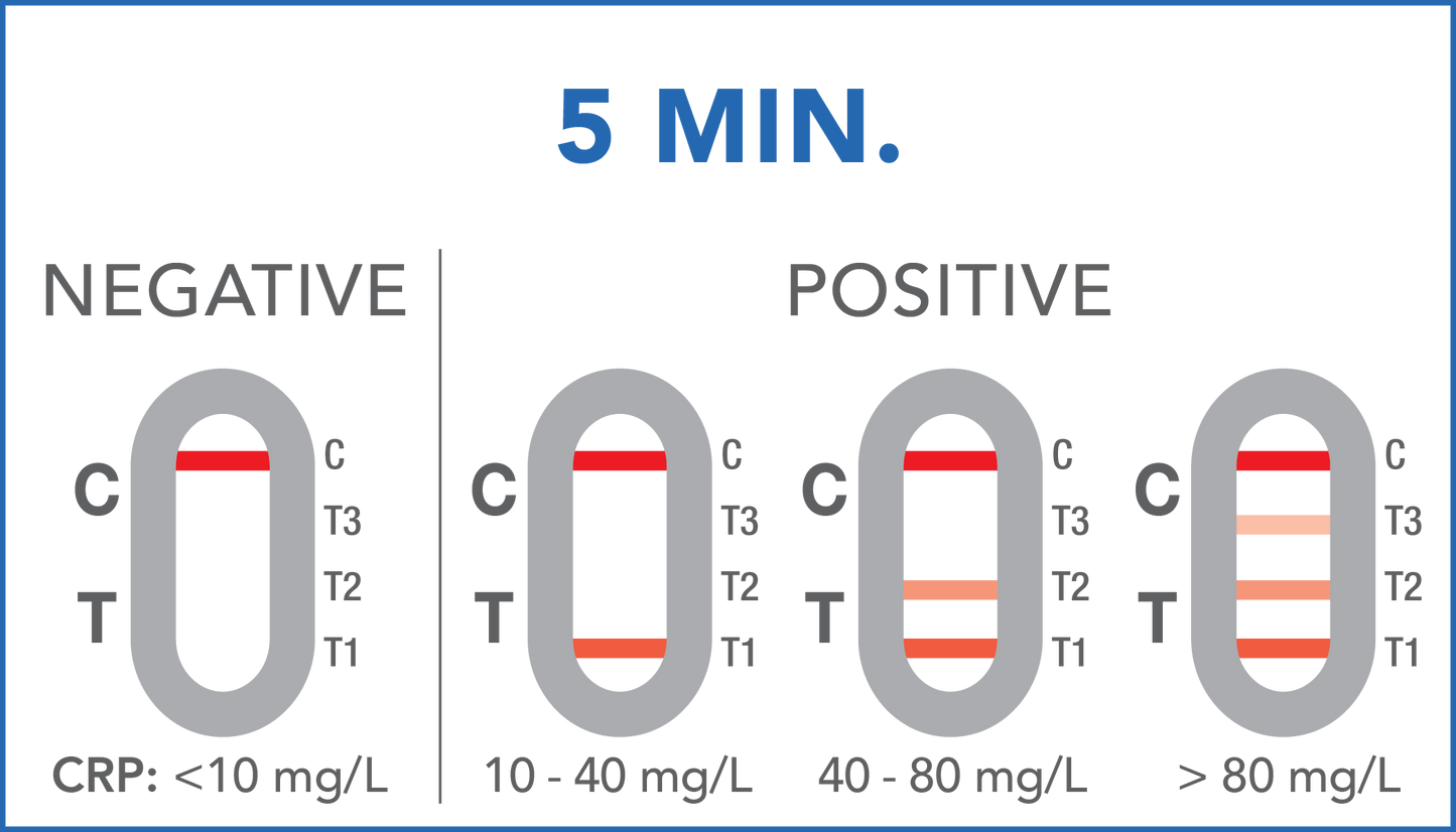 Entzündungs- und Infektionstest (C-reaktives Protein)